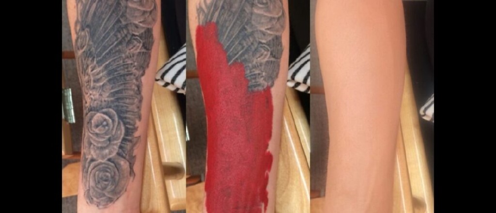 Before and after of a tattoo cover-up